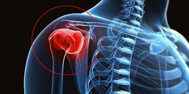 forum cum să tratezi durerile articulare artroza deformantă a articulațiilor gleznei 2 lingurițe